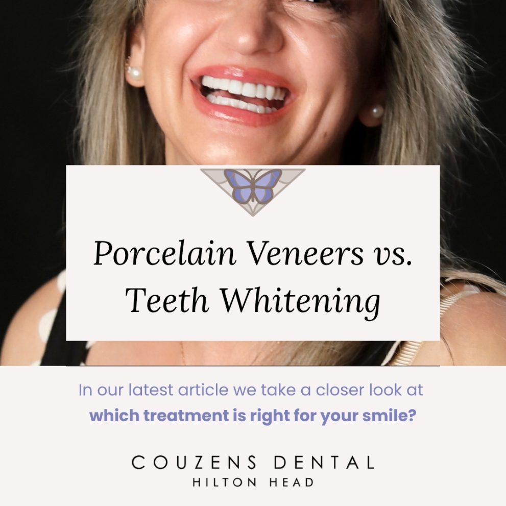 Compare veneers and professional whitening to see which option may better address your smile goals. Couzens Dental serves Hilton Head Island, SC.